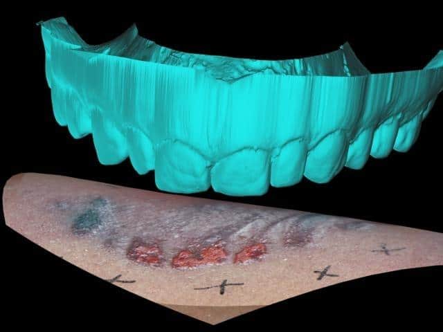 Bite Marks and Blindfolds: The Unseen Dangers of Forensic Dentistry